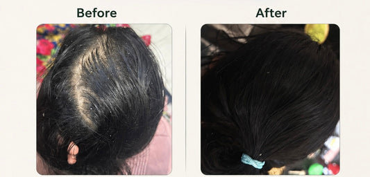 Stop - hair fall control oil by ayvlyn Ayvlyn.pk