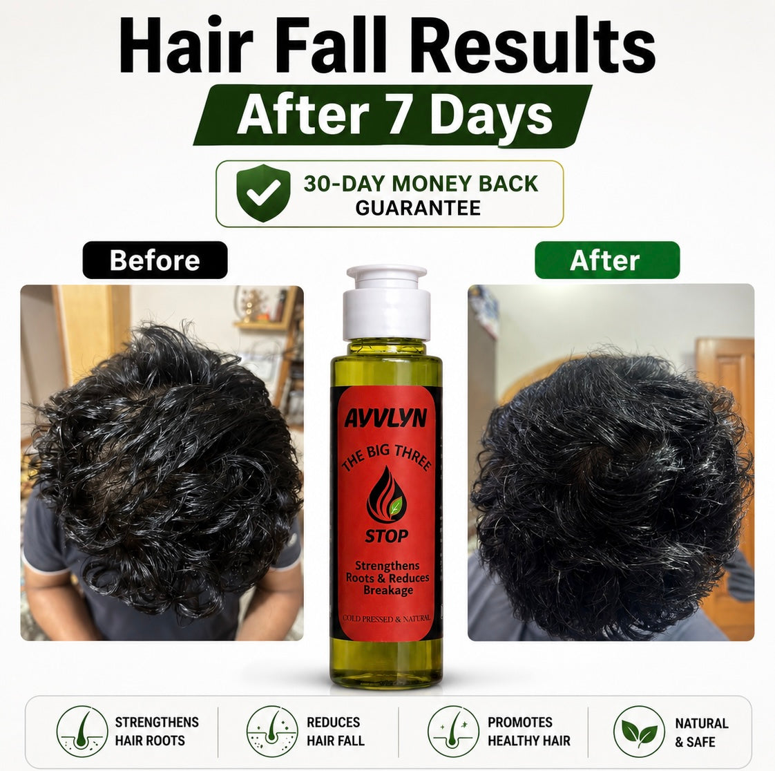 The Big Three | Growth, Hair fall & Anti-Dandruff Oils Ayvlyn.pk