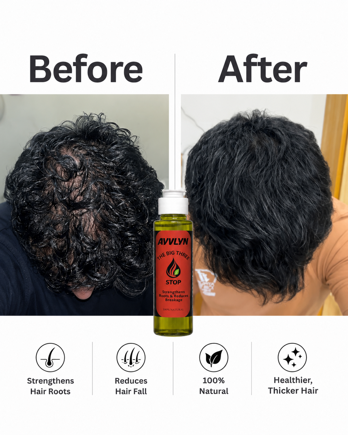 Stop - hair fall control oil by ayvlyn Ayvlyn.pk